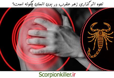 زهر عقرب چگونه بر بدن انسان تاثیر می گذارد